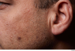 Face Cheek Ear Hair Skin Man Birthmarks Chubby Studio photo references